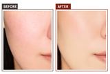 24K Gold Microcurrent Face & Neck Massager