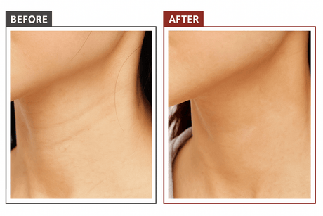 24K Gold Microcurrent Face & Neck Massager