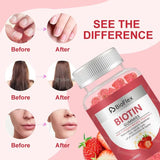 Biotin Collagen Keratin Gummies – Beauty Vitamins for Hair, Skin & Nails
