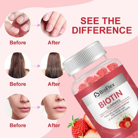 Biotin Collagen Keratin Gummies – Beauty Vitamins for Hair, Skin & Nails